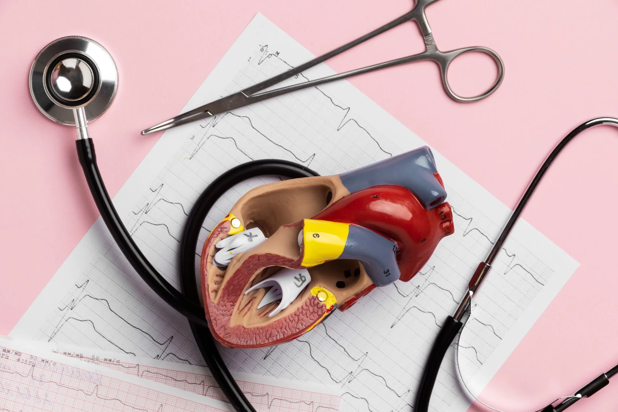 anomalies cardiaques