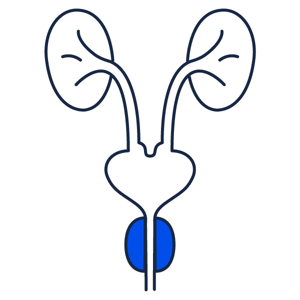Hypertrophie bénigne de la prostate (HBP): La pathologie
